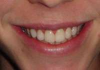 dentists wellington 445